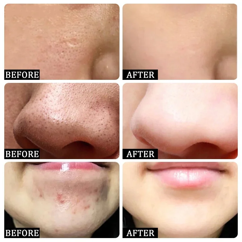 Salicylic Acid Pore Clearing C - Korean Skincare Routine recensie en prijs
