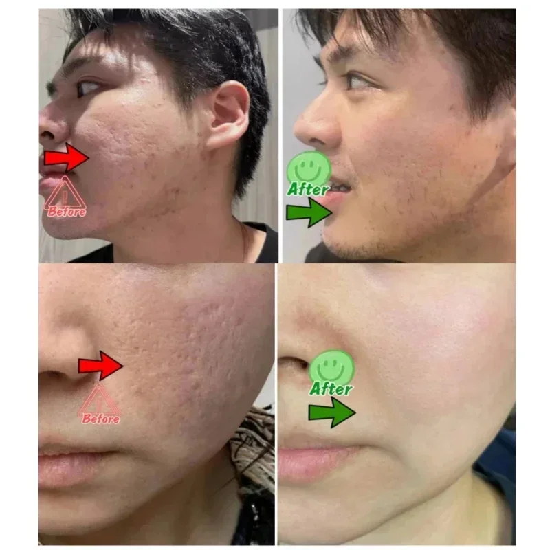 Salicylic Acid Pore Clearing C - Korean Skincare Routine recensie en prijs