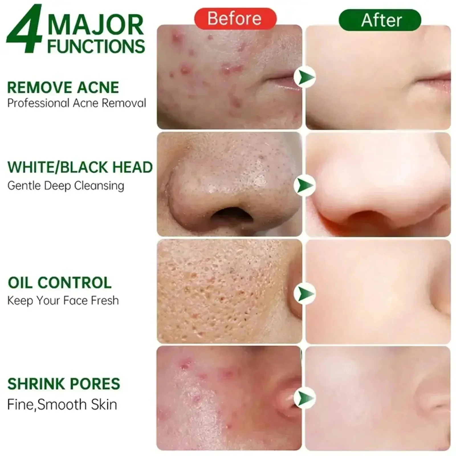Salicylic Acid Pore Clearing C - Korean Skincare Routine recensie en prijs