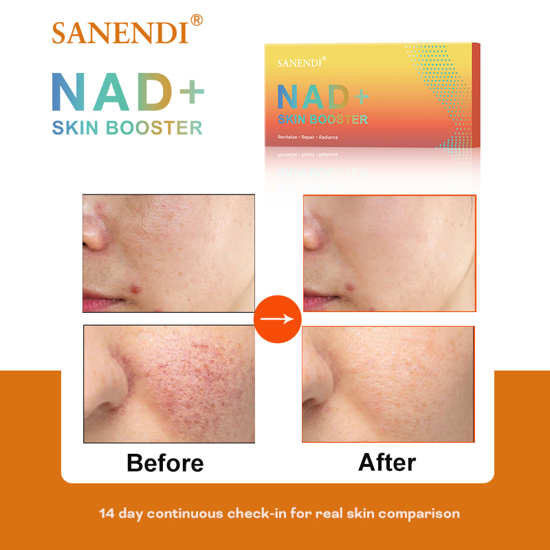 Sanendi NAD+ Korea Skincare Pr - Korean Skincare Routine recensie en prijs