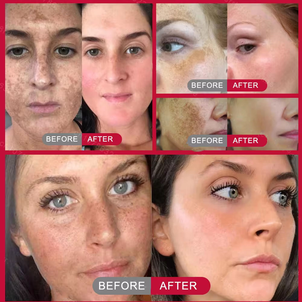 Powerful Spot-removing Whiteni - Korean Skincare Routine recensie en prijs